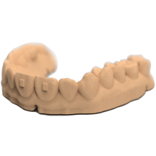 3D打印牙科樹(shù)脂